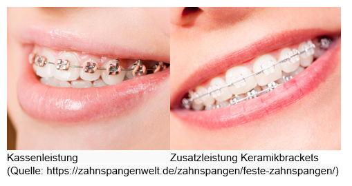 Zahnspange // ADAMIETZ & KOLLEGEN GmbH